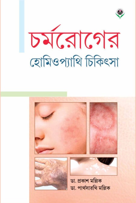 চর্মরোগের হোমিওপ্যাথি চিকিৎসা || CHARMAROGER HOMOEOPATHY CHIKITSA